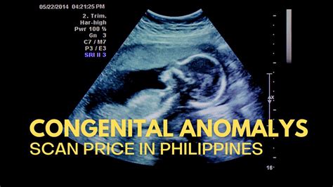 congenital anomaly scan price manila